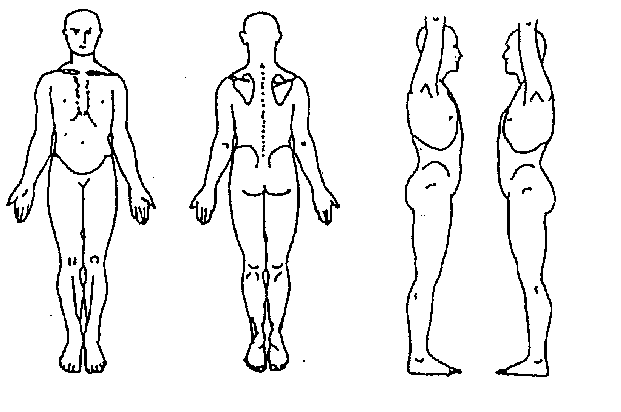 Ķermeņa diagramma